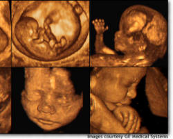 Image of A baby is a human being, a person entirely distinct and separate from you and me. An individual. Not an extension of me, nor an extension of you. A brand-new man or woman. 
