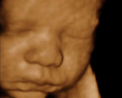 Image of 'I’m sorry,' the doctor said. 'There appear to be multiple complications. The ‘fetus’ appears to have club feet. There is no sign of the presence of a bladder. It may be external to the body. And the brain is not developing as it should. There is an empty space at the base of the brain. They rarely make it to full term in cases like this. Those that are born are likely to die within the first year.'