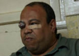 Image of The Islamic attack on St. Mina Church in Cairo sent a piece of glass into the eye of Ramses Roushdy. Photo provided by Compass News Service.