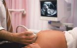Image of Sonograms are better than ultrasounds for showing mothers the reality of the baby they carry, and may be choosing to abort.