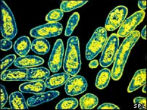 Image of TB infects nearly 1/3 people worldwide and is one of the top 10 leading causes of death.