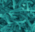Image of Listeria bacteria as imaged under a microscope.