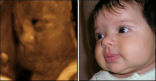 Image of Where's the difference?