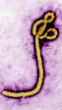 Image of A famous image of the Ebola virus. There are multiple strains of the Ebola virus which occasionally infect victims in equatorial Africa.