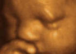 Image of 