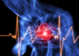 Image of Broken heart syndrome symptoms are like heart attack symptoms.