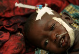 Image of A malaria infected child receiving treatment.