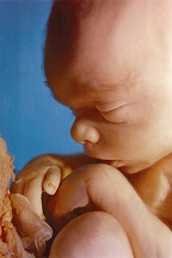 Image of We all know they are all members of our human family. Our 4D sonogram technology has made it possible to take baby´s first picture and send it as a birth announcement or place it on a Face Book or My Space page. We send it through our Social Networks.
We marvel at the image of those little babies at the early stages of what is a lifetime of development for every human being. We then use that same technology to direct the weapons of warfare which will dismember them in the womb and kill them. We do not want to see those pictures.