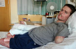 Image of A British man has lost all four of his limbs after a common cold developed into a rare flesh-eating bacteria.