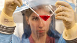 Image of A potential serum from the blood of infected and recovered Ebola patients could provide the key to halting the ongoing outbreak.