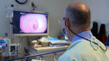 Image of The Mayo Clinic has a new test for colon cancer that is less invasive or arduous than previous screening tests.