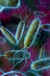 Image of Drug resistant infections, like E. coli, are expected to resist more antibiotics, making infection prevention impossible.