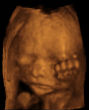 Image of 10,000 babies are killed each year through late-term abortions.