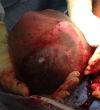 Image of (Cedars-Sinai Medical Center in Los Angeles)