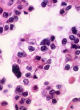 Image of The World Health Organization provided a list of 116 chemicals and activities that show signs they could cause cancer.
