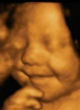 Image of Baby (not pictured) is recorded dancing in 4D ultrasound (MEN).