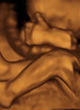 Image of 4D images reveal what the unborn do in the womb (Window to the Womb).