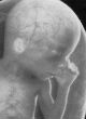 Image of New study indicates false positives for fetal abnormalities.