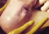 Image of The child was born in the intact amniotic sac.