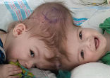 Image of Jadon and Anias had to be born via c-section last September (Facebook).