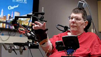 Bill Kochevar is now able to move his arm again using a brain implant that translates his thoughts into motion.