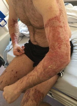 One man was attacked in the street by complete strangers (Chris Bonney/Facebook).