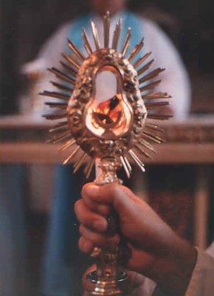 Eucharist miracles exist.