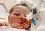 Image of Charlie Gard was diagnosed with a very rare syndrome.