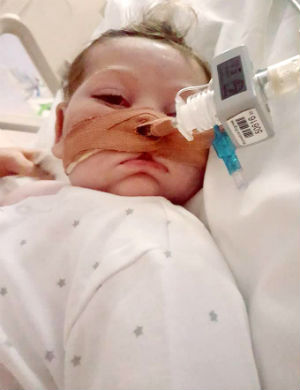 Charlie Gard was diagnosed with a very rare syndrome.