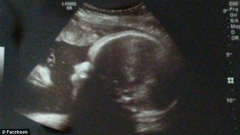 Can you spot the face of Jesus in the ultrasound?