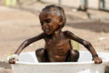 Image of Over 20 million people in South Sudan, Somalia, Northeast Nigeria, and nearby Yemen are facing famine and starvation.