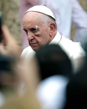 Pope Francis is reportedly 'fine' after his bloody injury in Colombia.
