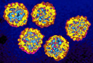 Hepatitis is a killer, and takes more lives than HIV, tuberculosis, and malaria combined. It can be treated cured, but the political will to eradicate the disease is low.