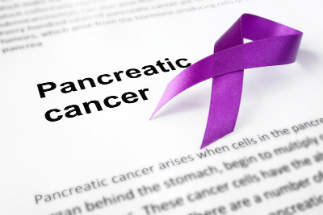 Pancreatic cancer is one of the most lethal forms of the disease.