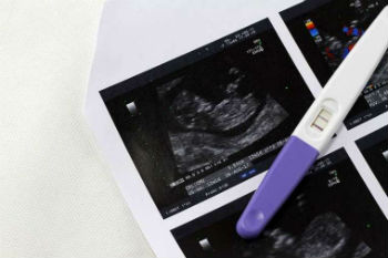 Pregnancy test