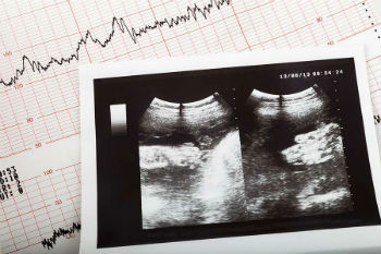Cardiogram ultrasound baby pregnant
