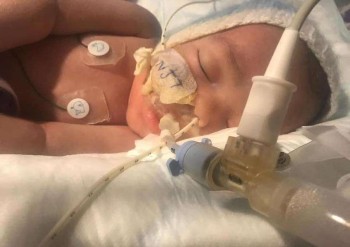 Image of Infant boy