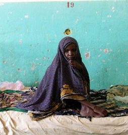 Image of An Ethiopian girl is treated for malnutrition and tuberculosis at a hospital in Kabridahar. The African Child Policy Forum (ACPF) has warned that Ethiopia will by 2010 see a four-fold increase in the number of orphaned children aged between nine and 19 who are heading families due to AIDS, poverty and conflict.