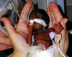 Image of I propose to the US Congress a new framework. I invite them not only to exclude the killing of children (abortion) but to include our youngest neighbors under the plan!