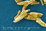 Image of Drug resistant TB threatens the entire world and the WHO is calling upon all nations to fight the disease. 