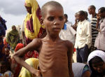Image of Children are among the first to suffer. About 50,000 children are already starving to death in Somalia. 
