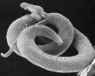 Image of The schistosomiasis worm is a dangerous parasite which can increase the risk of HIV infection. It can also be cured with a pill that costs eight cents. 