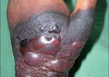 Image of Ebola has a very high death rate.