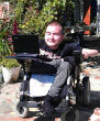 Image of Valery Spiridonov plans on being the first recipient to a human head transplant (East2WestNews).