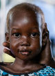Image of Four-year-old Nyajime Guet suffered severe acute malnutrition and weighed less than 20 pounds when she was taken to a UNICEF-backed clinic for help (UNICEF/UNI201744/Rich).