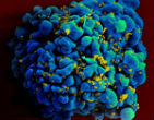 Image of HIV continues to destroy the lives of people who engage in promiscuous behavior. 
