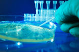 Image of Scientists know about an amazing STD solution that is 100 percent effective. So why aren't we using it? 