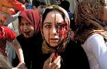Image of Wounded civilians in Aleppo seek refuge as Syrian troops retake the last rebel-held district. 