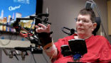 Image of Bill Kochevar is now able to move his arm again using a brain implant that translates his thoughts into motion.