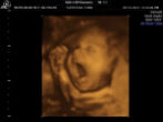 Image of Does this look like a baby or a cluster of cells? 